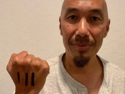 A man showing the marks drawn on the back of his hand